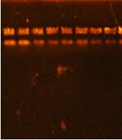 Jundishapur J Microbiol